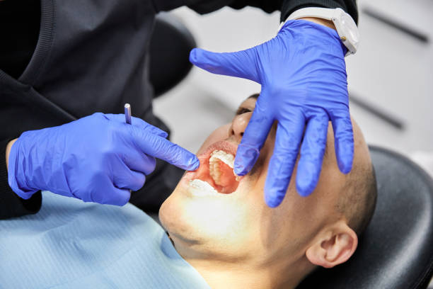 Best Dentist for Tooth Abscess  in Seeley, CA